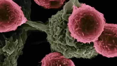 Droga mascarada de cancer mata tumores enquanto poupa tecido saudavel