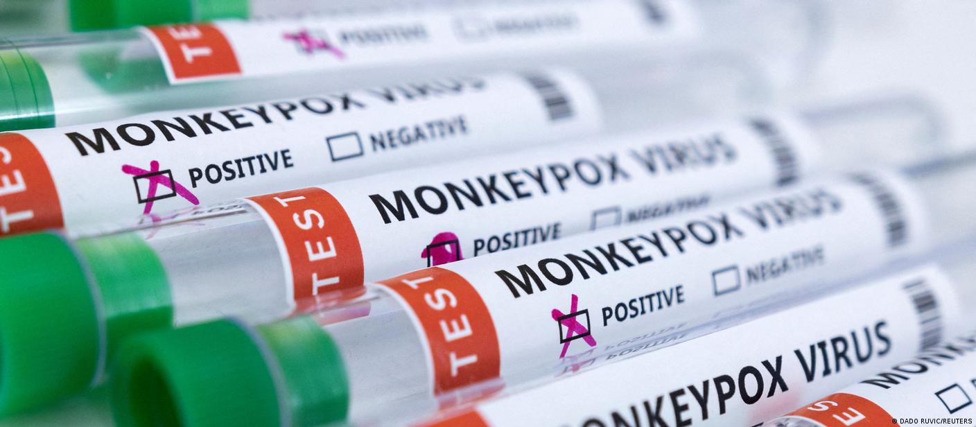 OMS registra 780 casos de variola dos macacos em 27 paises