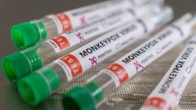 Saude confirma setimo caso de variola dos macacos no pais