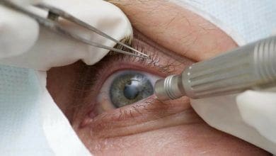 Doenca ocular relacionada a idade pode levar a cegueira