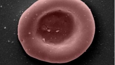 Realizada primeira transfusao de globulos vermelhos cultivados em laboratorio