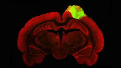 Experimento inedito no mundo cura lesoes cerebrais em ratos usando minicerebros humanos