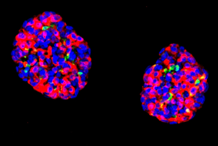 Celulas humanas sao reaproveitadas por cientistas para produzir insulina e reverter diabetes