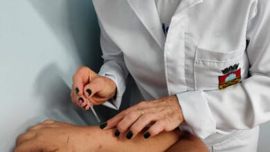 Secretaria de Saude de Erechim disponibiliza acupuntura para pacientes com fibromialgia