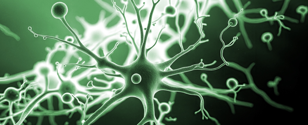 Estudo sobre Alzheimer revela como aglomerados toxicos deformam neuronios em seu nucleo