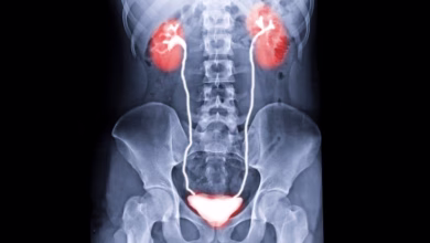 Realizado o primeiro transplante de bexiga humana no mundo